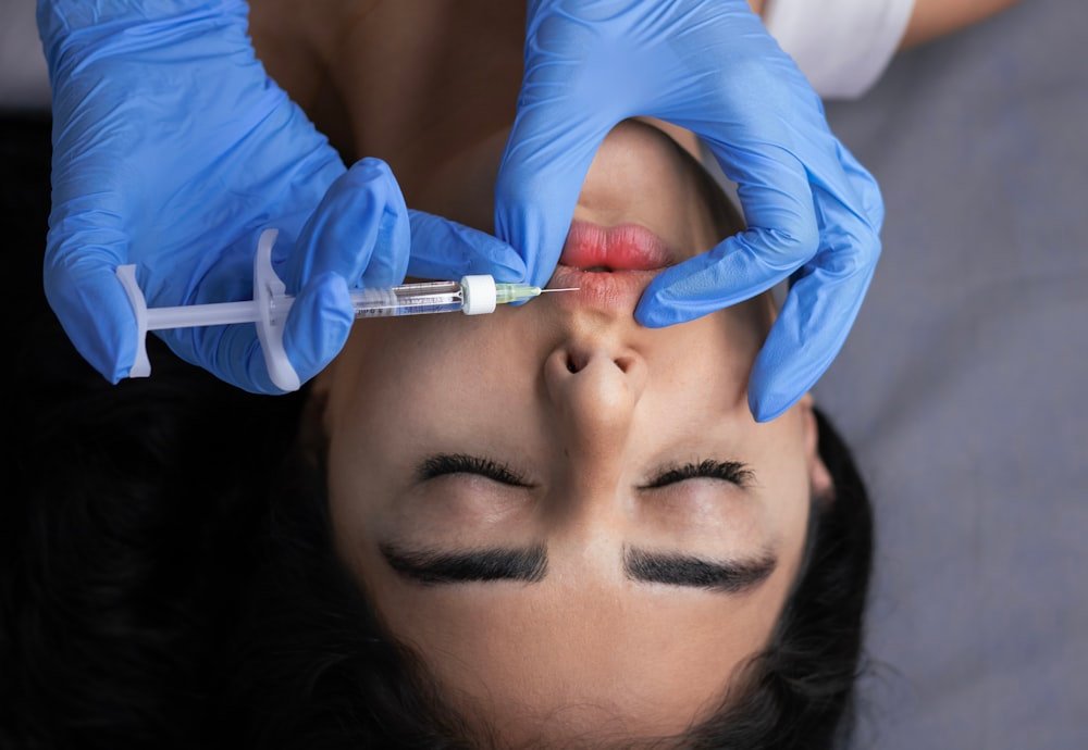 Close-up of a lip filler treatment